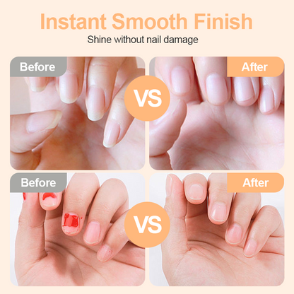 2-in-1 Elektro-Nagelknipser  ✨💅